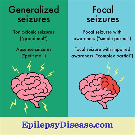 What Are The Types of Seizures With Epilepsy?