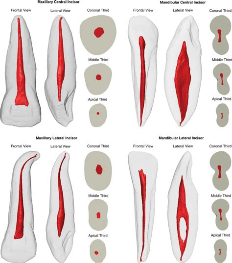 rák Melléktermék Egység maxillary canine root canal növekedés Bárki ...