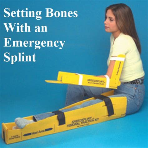 Setting Broken Bones with a Emergency Splint - The Prepared Page » The Prepared Page