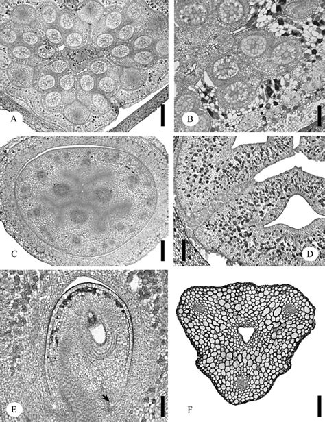 Androecium and gynoecium of Licuala peltata. A, Transverse section of ...