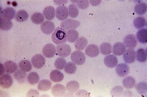 Free picture: micrograph, compact, plasmodium vivax, trophozoite