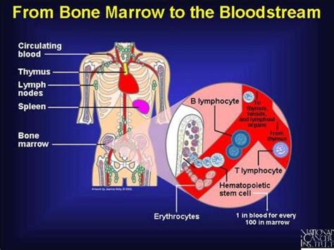 Presentation of stem cell and bone marrow tranplan tation