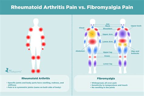 Causes of Rheumatoid Arthritis Pain Aside from Inflammation