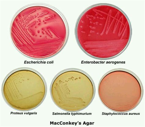 Placas de Agar macconkey | Microbiology lab, Medical laboratory ...