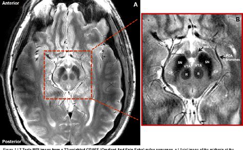 Figure 1 from Identifying the Functional Architecture of the Human ...