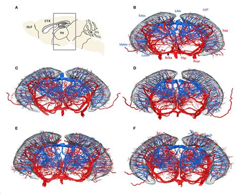 Figure 5 from Precise Cerebral Vascular Atlas in Stereotaxic Coordinates of Whole Mouse Brain ...