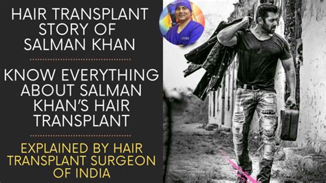 HAIR TRANSPLANT STORY OF SALMAN KHAN EXPLAINED BY HAIR TRANSPLANT SURGEON