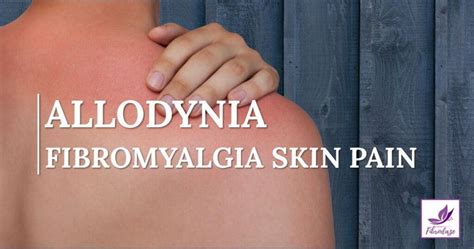 Allodynia: Fibromyalgia Skin Pain