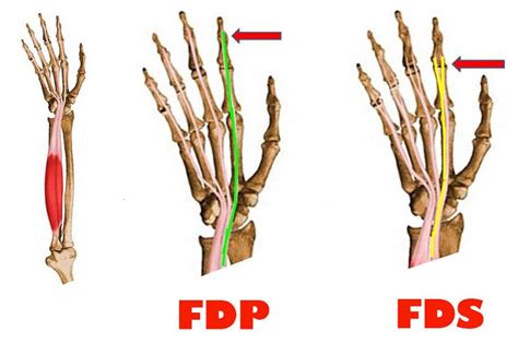 Common Finger Injuries from Rock Climbing