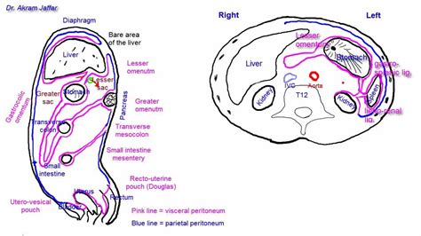 Tracing the peritoneum in sections - simplified - YouTube