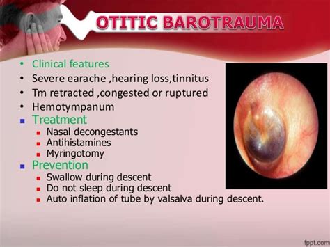 Otalgia/earache