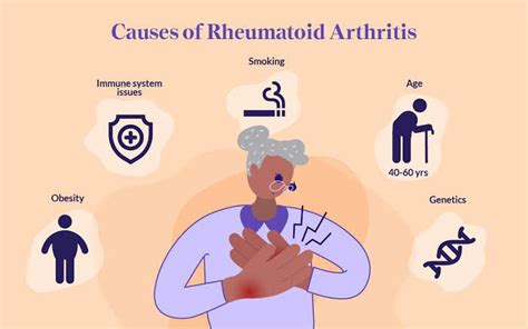 Causes of rheumatoid arthritis - MEDizzy