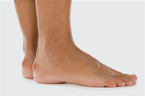 Heel Pain - Causes, Symptoms and Treatment | Sanders Podiatry Adelaide