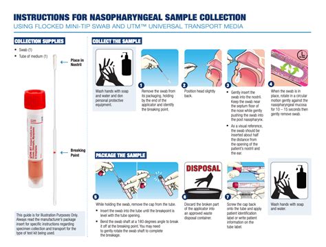 Nasopharyngeal Swab Wikipedia