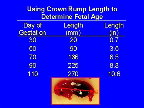 Using Crown Rump Length to Determine Fetal Age