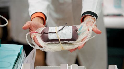 Exchange Transfusion: Purpose, Procedure, and Preparation