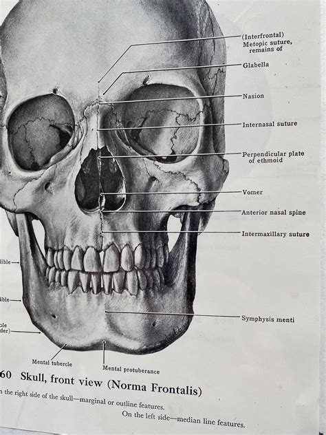 Framed Anatomical Skull Print Front View norma Frontalis - Etsy