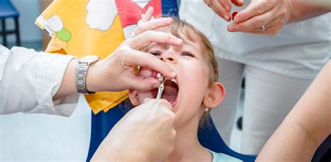 Tooth extractions amongst children reach record highs of almost 43,000 | PCP Dental Recruitment