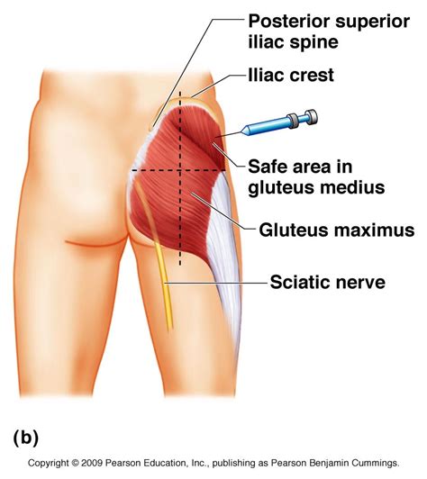 Gluteal Region Anatomy and Significance | Bone and Spine