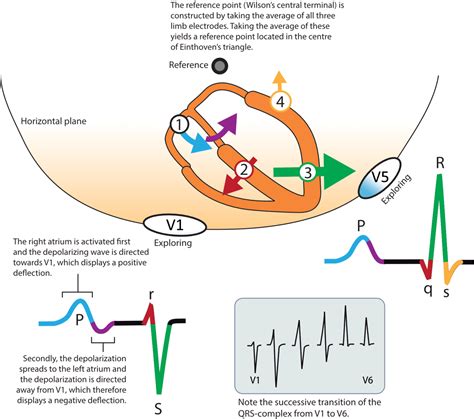 ECG interpretation: Characteristics of the normal ECG (P-wave, QRS ...