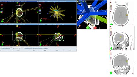 Cancer Therapy Centres » Radiation Oncology