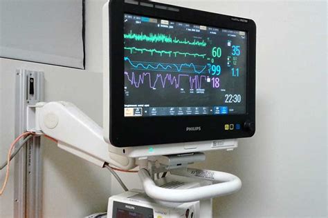 5-Lead ECG Placement and Cardiac Monitoring | Ausmed