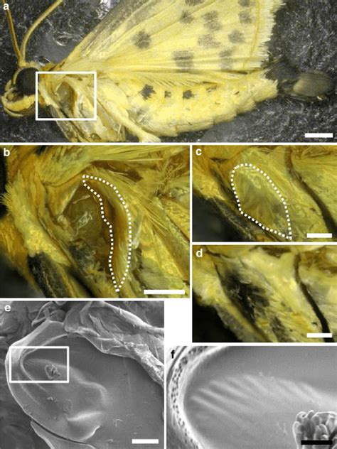 Male-specific mesothoracic tymbal that generates ultrasonic clicks in... | Download Scientific ...