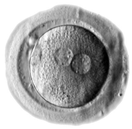 File:Human zygote two pronuclei 02.png - Embryology