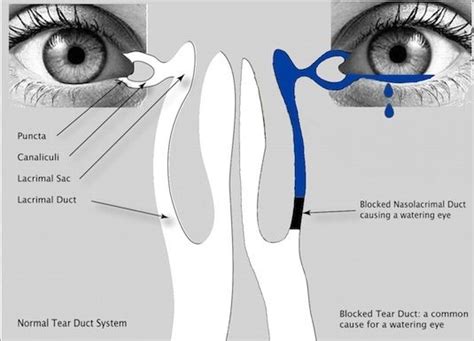 Eyelid Anatomy Duct
