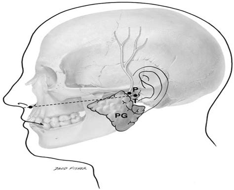 Parotid Branches of the Auriculotemporal Nerve: An Anatomica ...