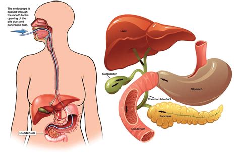 ERCP (Endoscopic Retrograde Cholangio-Pancreatography) Patient Information from SAGES