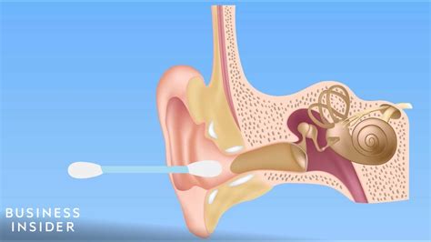 How to Get Sand Out Of Ear? | Detailed Guide - Beezzly