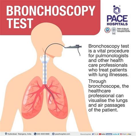 Normal Bronchoscopy