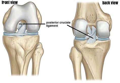 Posterior Cruciate Ligament Injury (PCL) | East Africa Orthopaedics