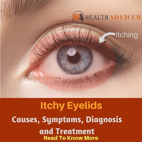 Itchy Eyelids: Causes, Picture, Symptoms, And Treatment