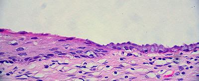 Uterus Histology - Cervix - histology slide