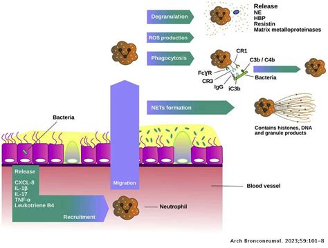 Pathophysiology of Chronic Bronchial Infection in Bronchiectasis | Archivos de Bronconeumología