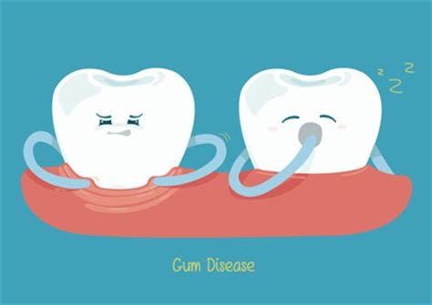 Tips for Gum Recession Prevention - Healthy Smiles Dentistry Georgetown Georgetown Texas