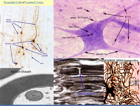 Anaxonic Neuron Slide