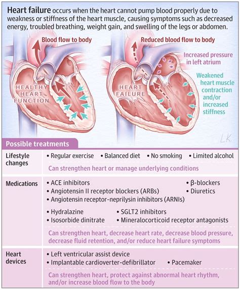 Describe the Pathophysiology of Left Sided Heart Failure