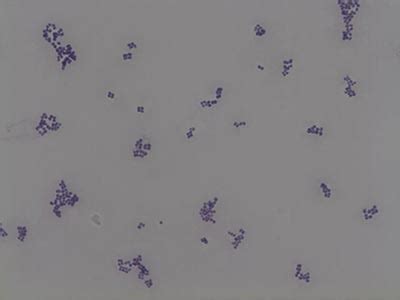 Micromorphology Slides - Microbiology Resource Center - Truckee Meadows Community College