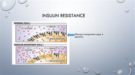 What Is Insulin Resistance (And Hyperinsulinemia?) - Thinlicious