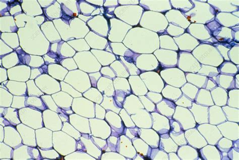 LM of white adipose tissue - Stock Image - P760/0008 - Science Photo Library