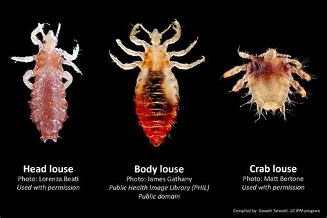 How to distinguish between head, body, and crab lice? – Urban IPM SoCal