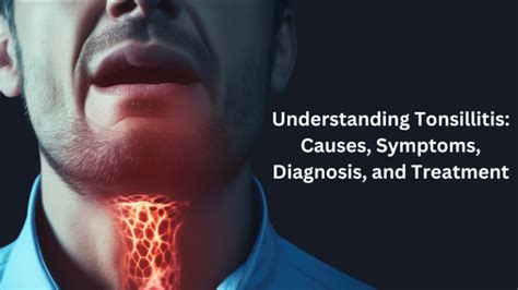 Understanding Tonsillitis: Causes, Symptoms, Diagnosis, and Treatment ...