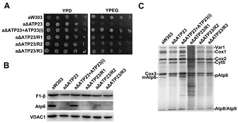 IJMS | Free Full-Text | T1121G Point Mutation in the Mitochondrial Gene ...