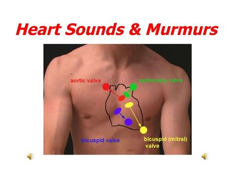 Heart Murmur Diagram