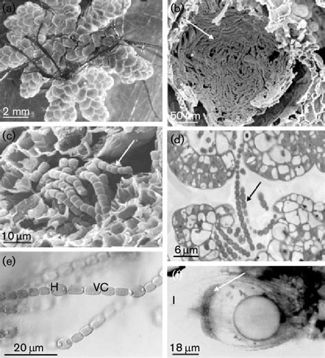 Aspects of the Azolla filiculoides-Anabaena azollae symbiosis. (a)... | Download Scientific Diagram