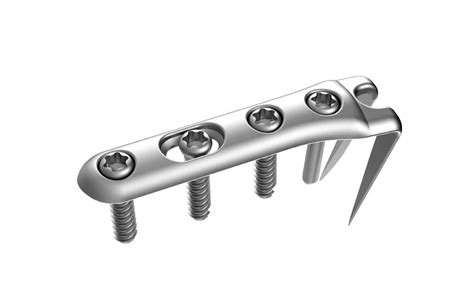 Dorsal Hook Plate - Upper Extremity Orthopedic Implants - TriMed Inc.