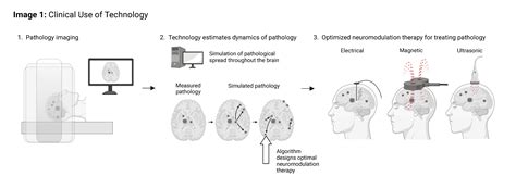 Pathology modifying neuromodulation therapy design | Explore Technologies